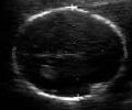 U/S scan