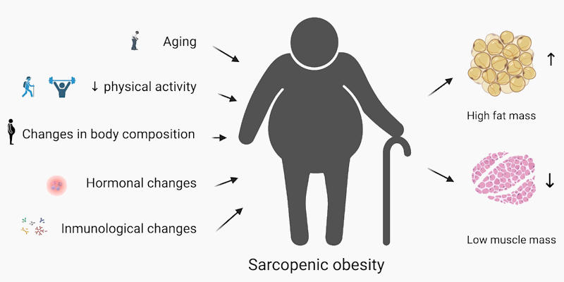 Sarcopenic Obesity