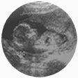 U/S scan